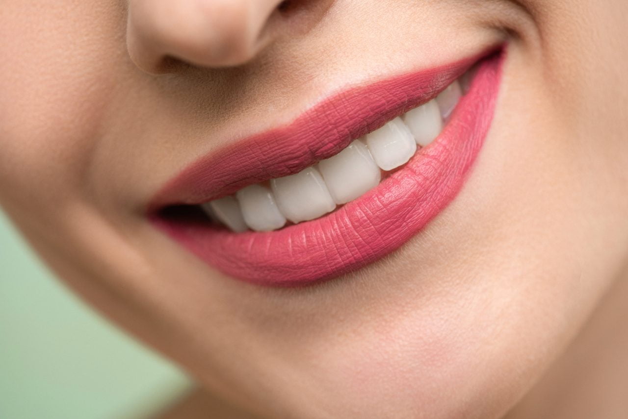 Sonrisa de una paciente adulta