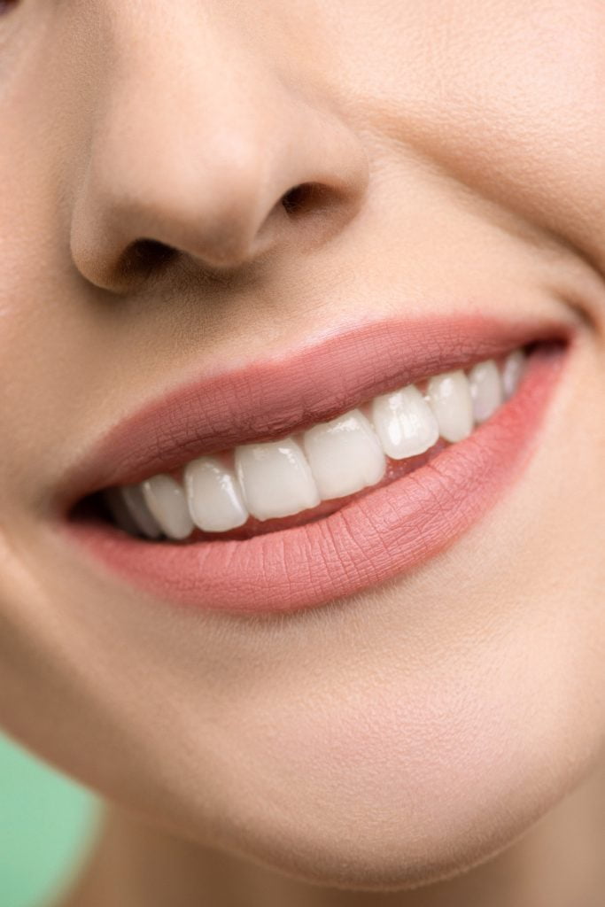 Sonrisa natural después de un tratamiento de blanqueamiento dental profesional