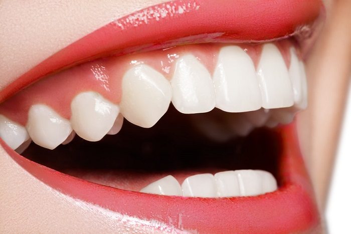 Sonrisa natural y armónica tras un tratamiento de estética dental