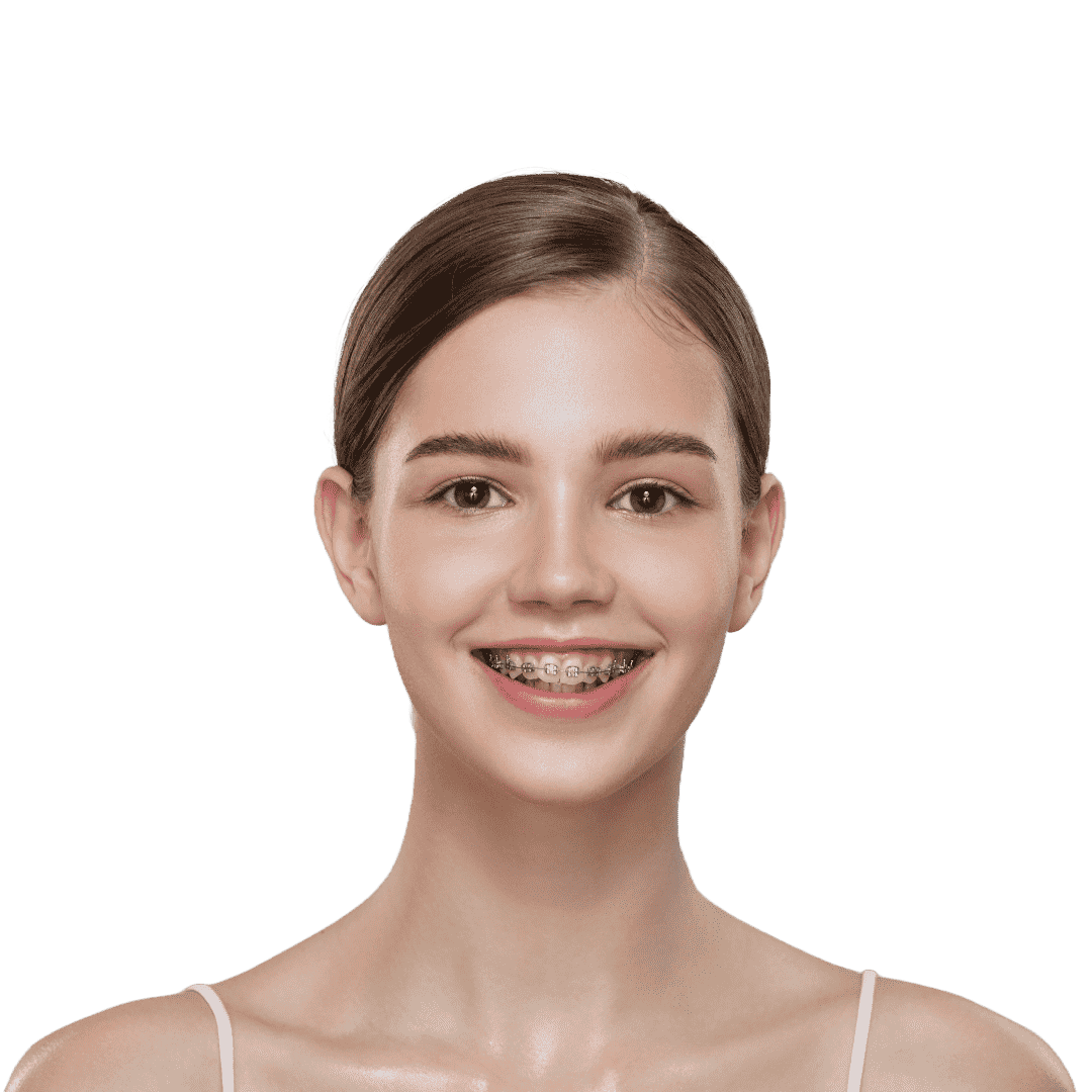 Paciente joven sonriendo con brackets de ortodoncia