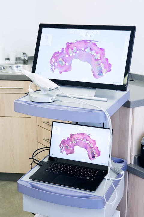 Escáner intraoral digital de vfclinic mostrando un modelo dental en 3D
